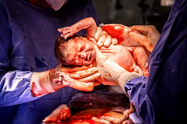 Newborn baby with placentaplacenta
